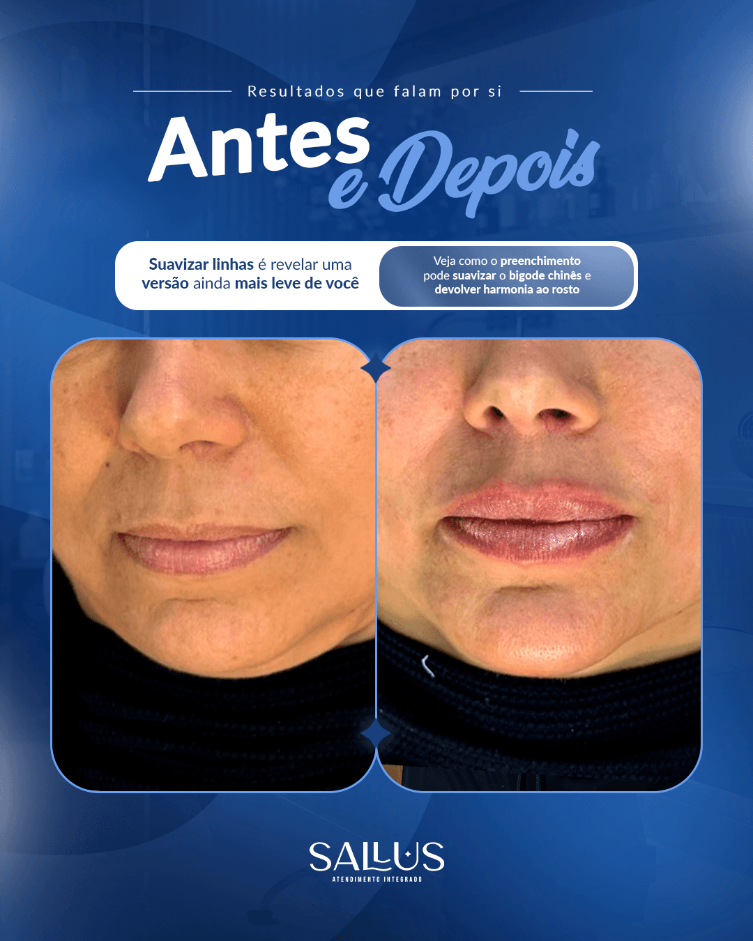 Antes e depois 02