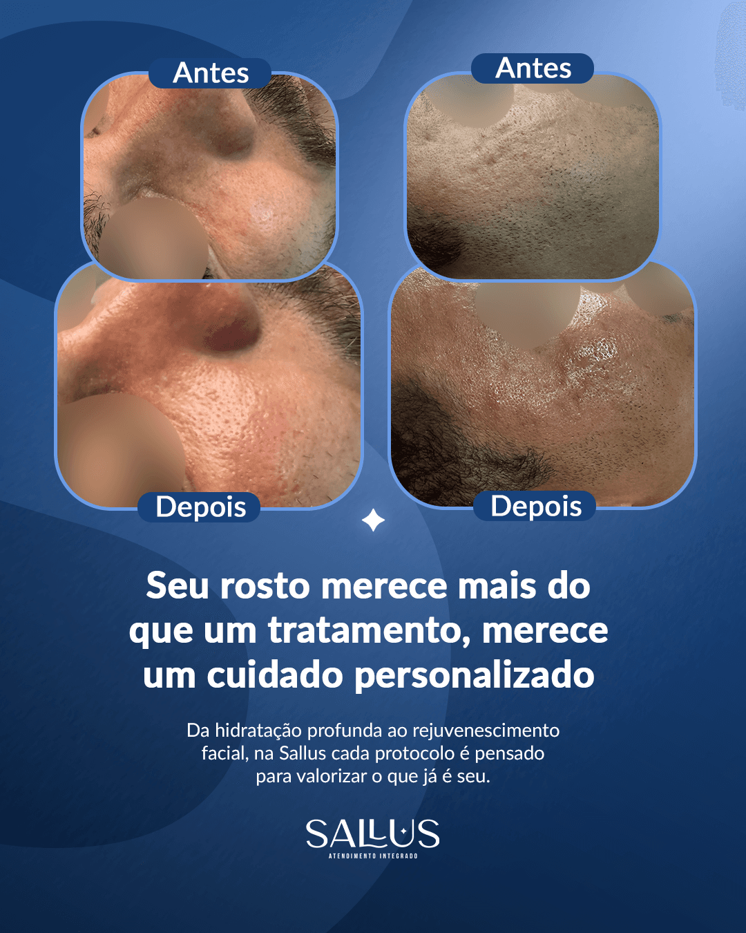 Antes e depois 04