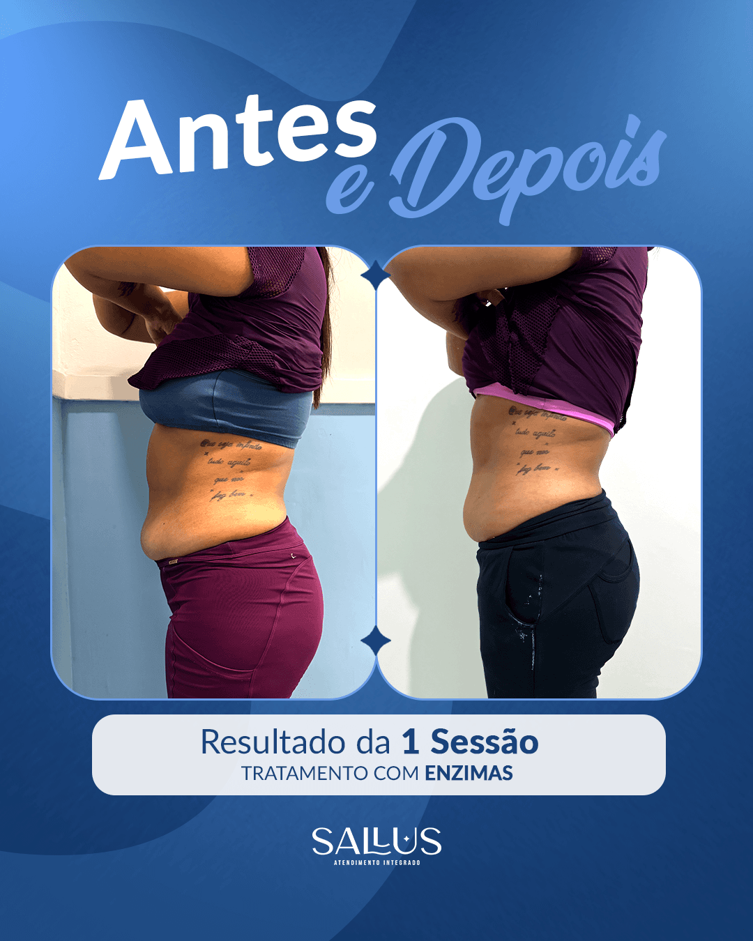 Antes e depois 05