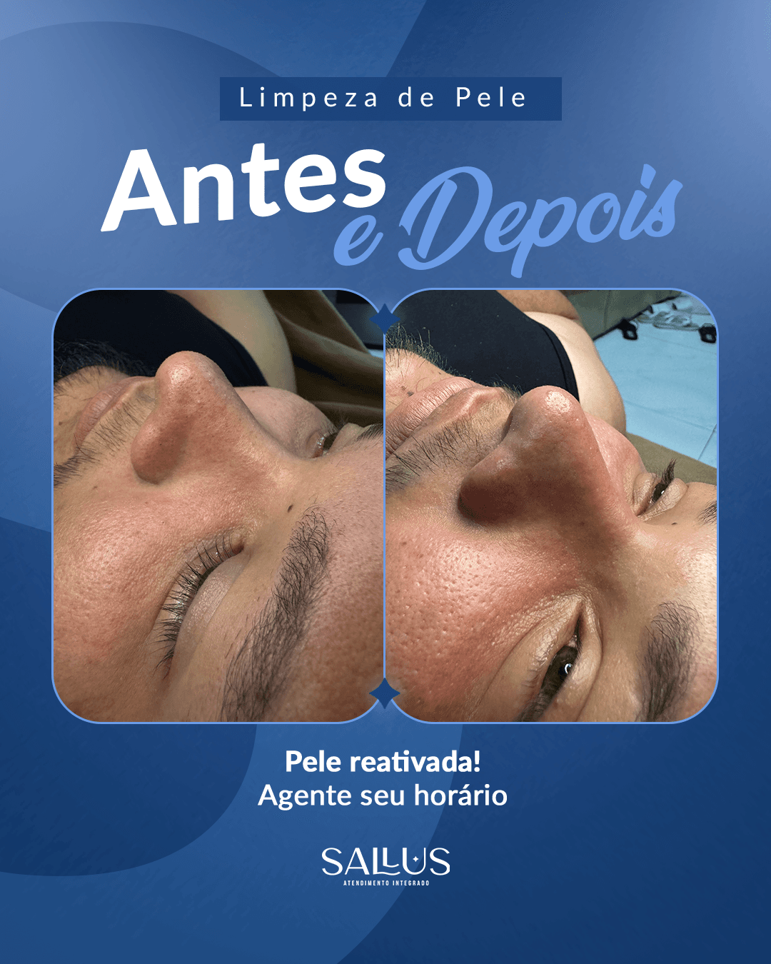 Antes e depois 06