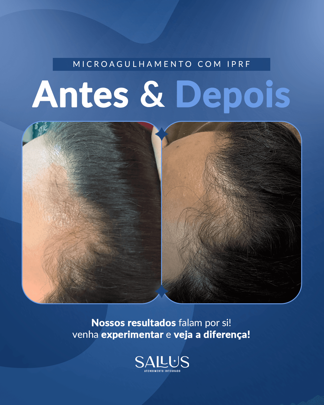 Antes e depois 08