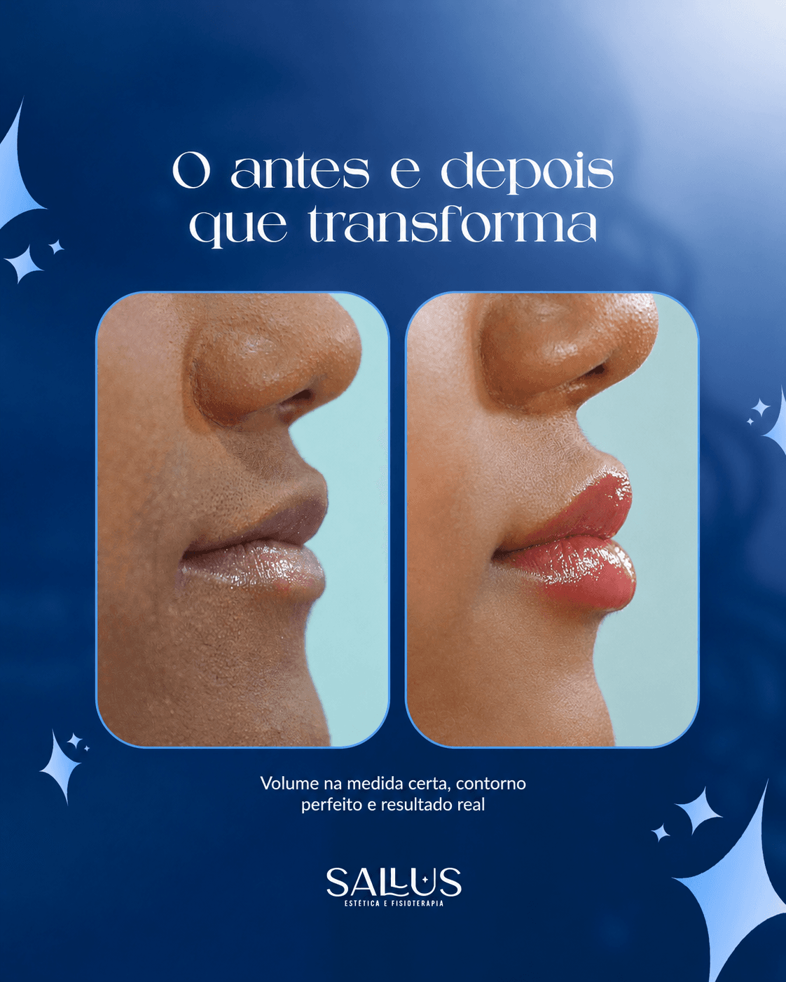 Antes e depois 10