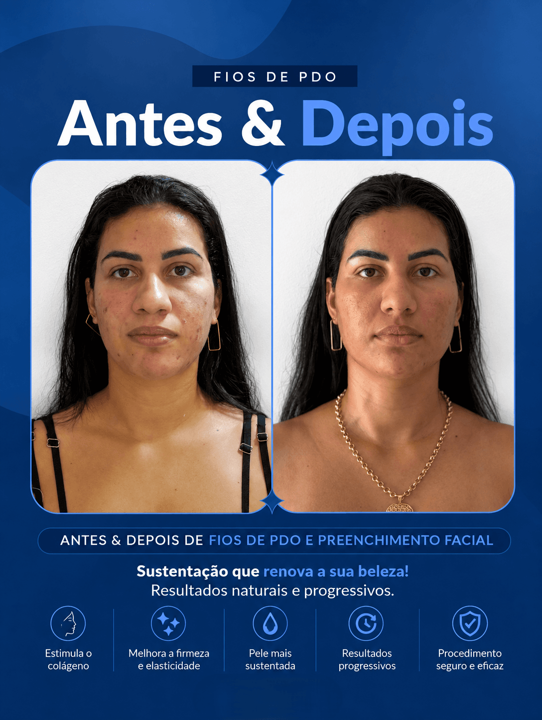 Antes e depois 11