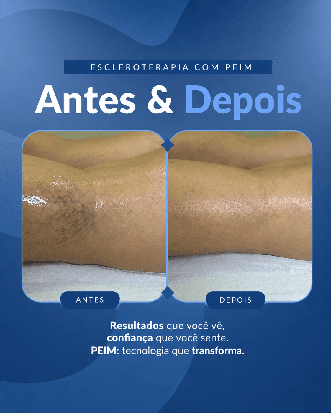 Antes e depois 13