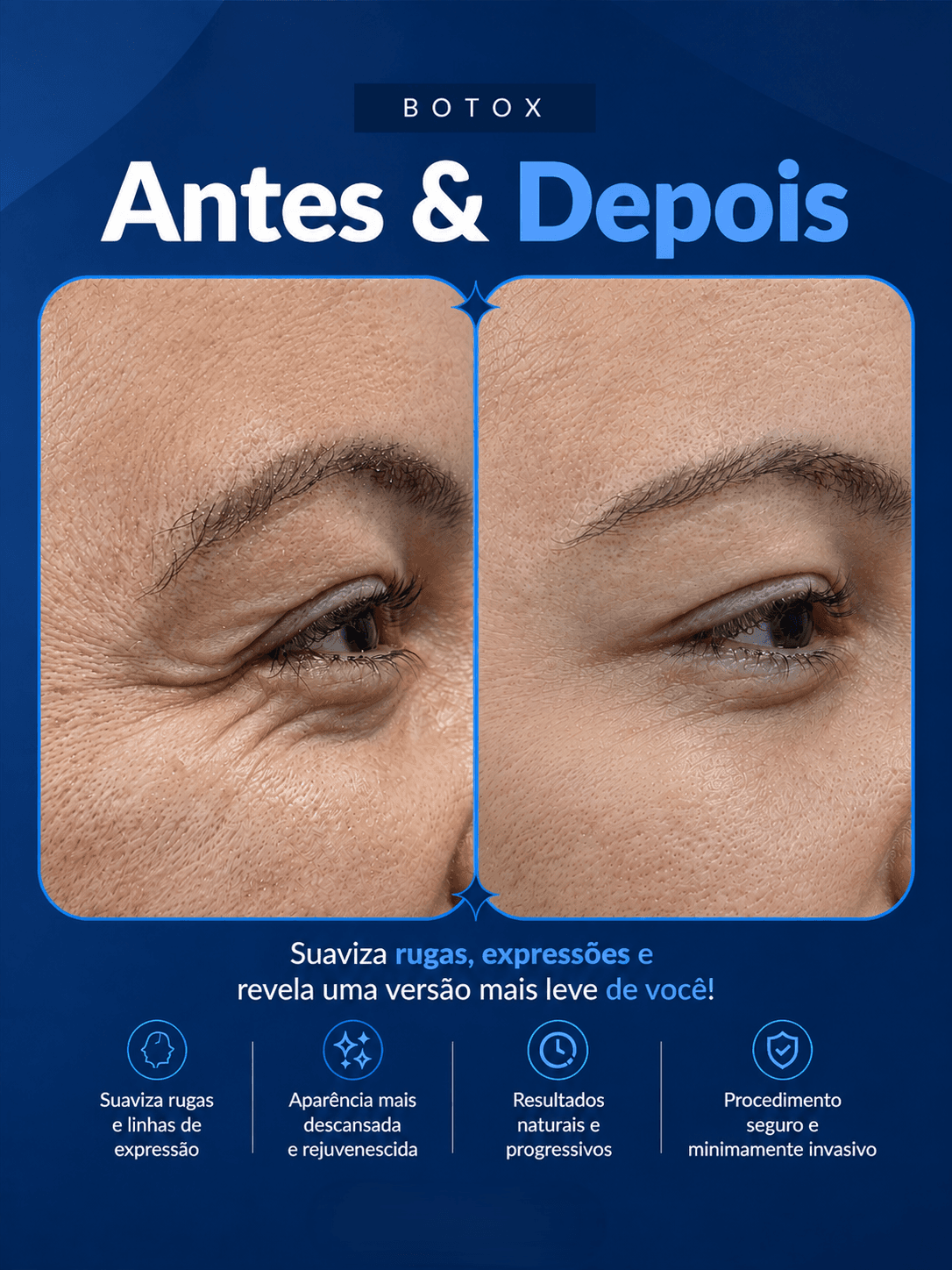 Antes e depois 14