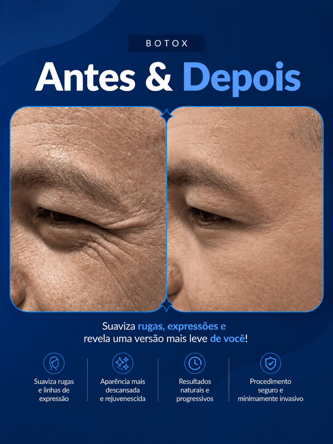 Antes e depois 15