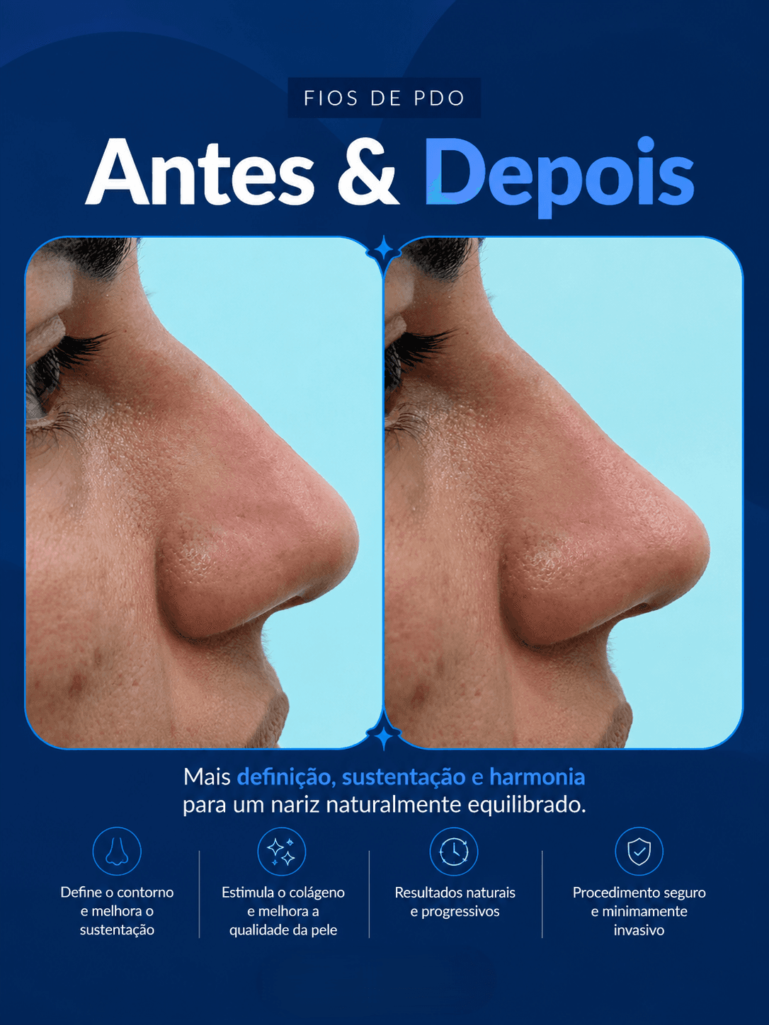 Antes e depois 16