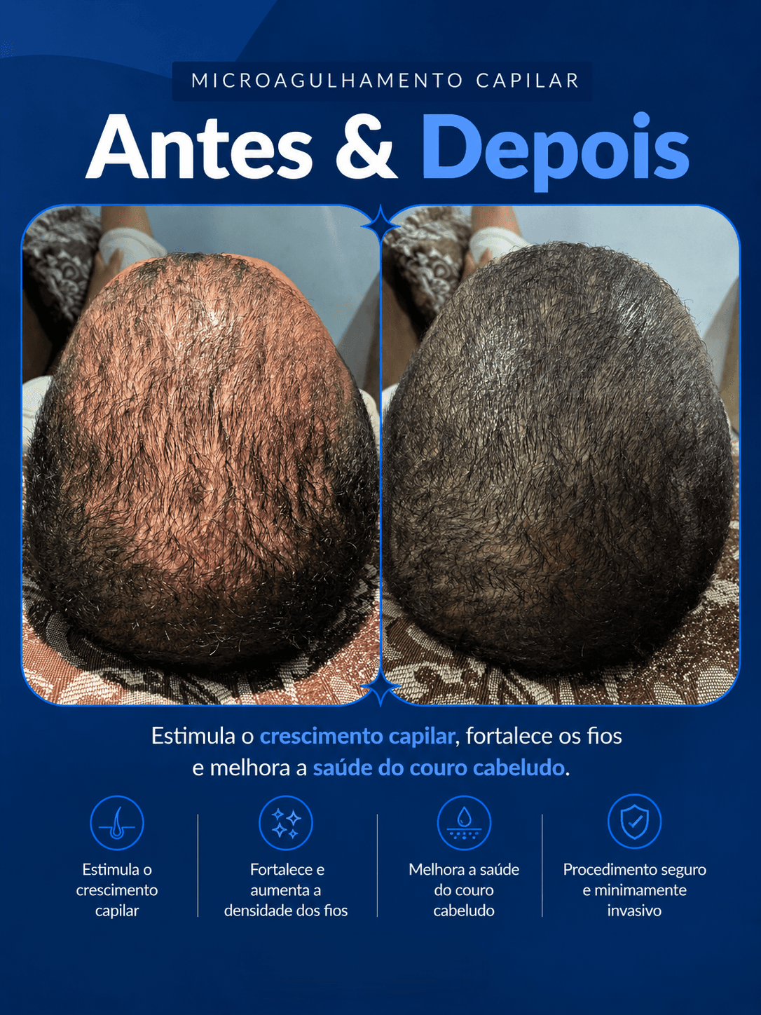 Antes e depois 17