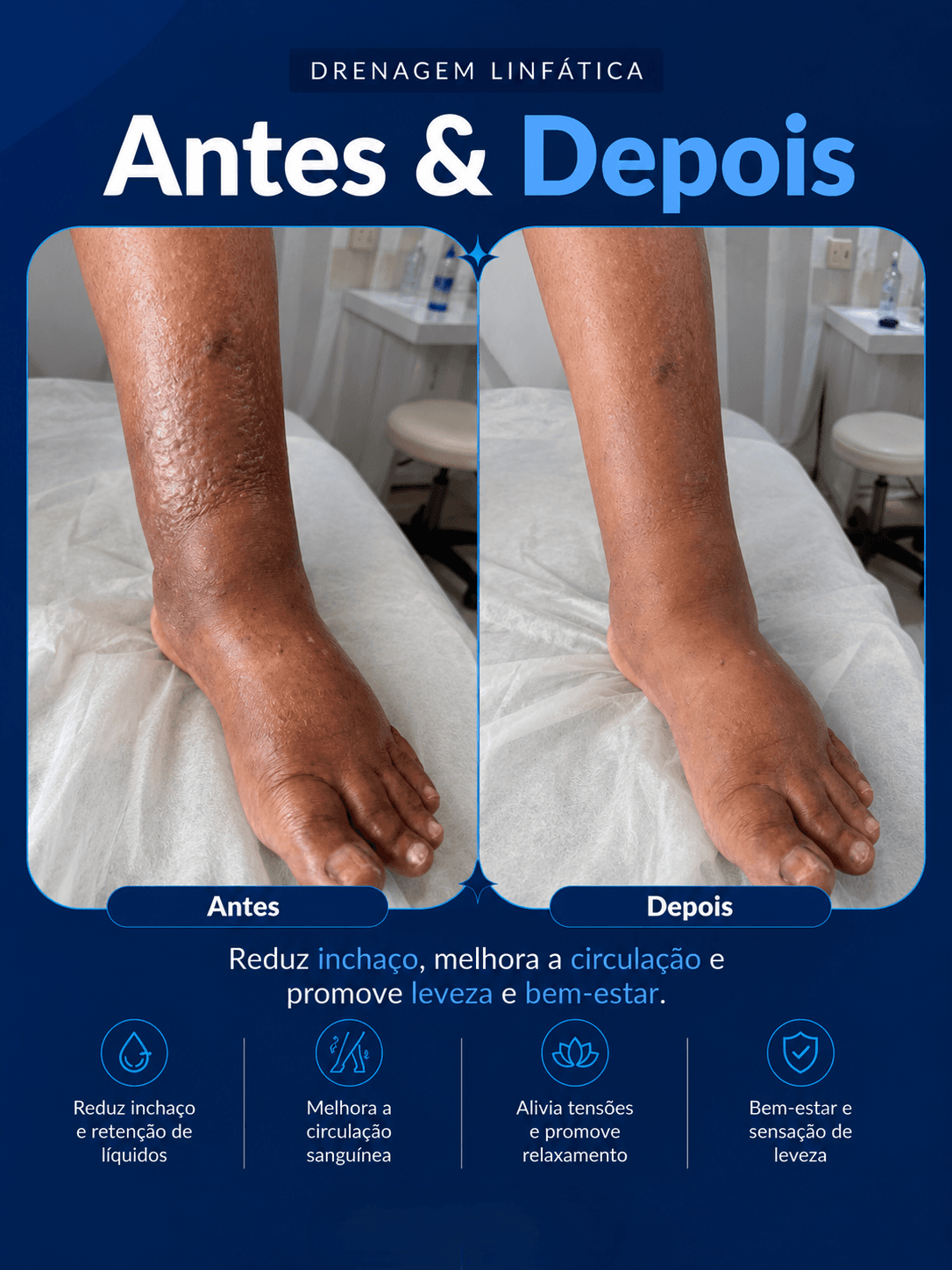 Antes e depois 18